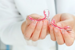 Ортодонтическое лечение с применением съемной аппаратуры